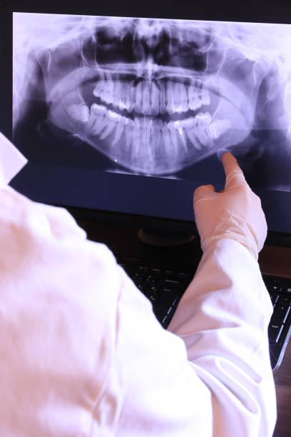 Best Emergency Wisdom Tooth Extraction in Lowell, OR